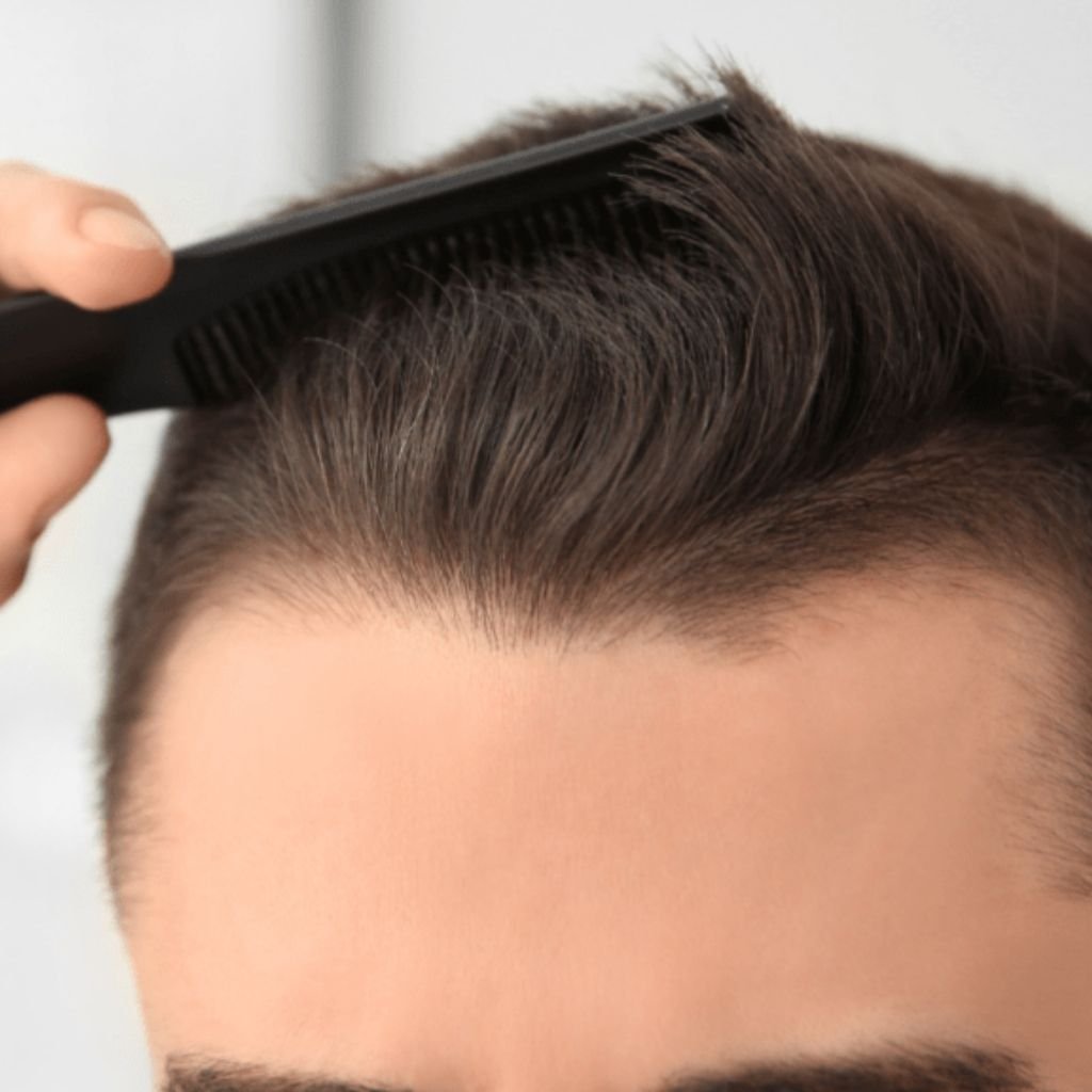 QR678 Neo peptide therapy results in Bengaluru: a close-up of healthy hair density and styling following advanced non-surgical hair restoration across Transform Head to Toe practice locations in Indiranagar, Bellandur, Koramangala, and Cunningham Road.
