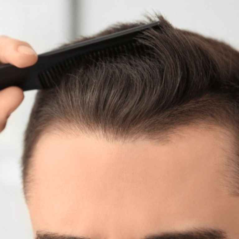 QR678 Neo peptide therapy results in Bengaluru: a close-up of healthy hair density and styling following advanced non-surgical hair restoration across Transform Head to Toe practice locations in Indiranagar, Bellandur, Koramangala, and Cunningham Road.