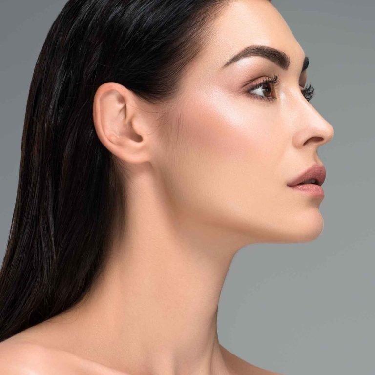 Side profile of a woman demonstrating a sharp, lifted jawline after Ultraformer III non-surgical skin tightening.